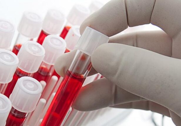 анализ крови после употребления алкоголя